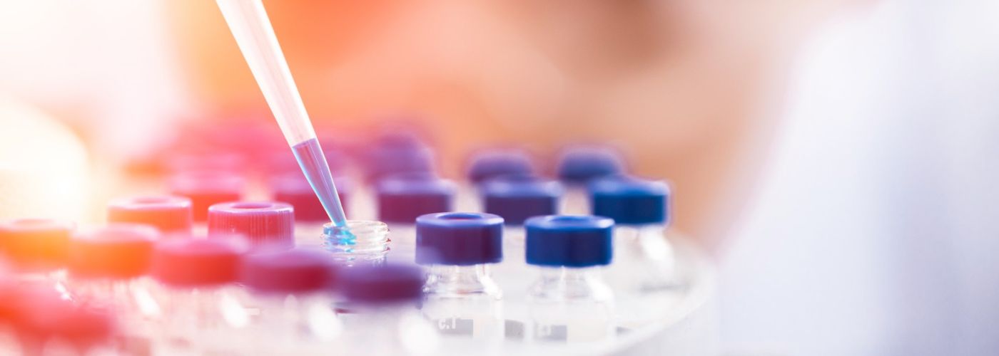 Pipette und Phiolen