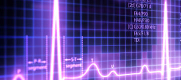 Risk consulting actuarial