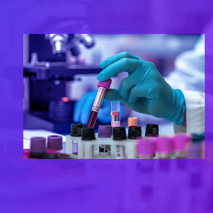 Gloved hand holding blood test tube in lab with microscope
