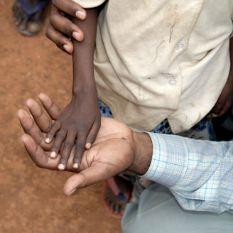 A thin refugee child's hand lies in the palm of an adults hand - Somalia refugee camp.